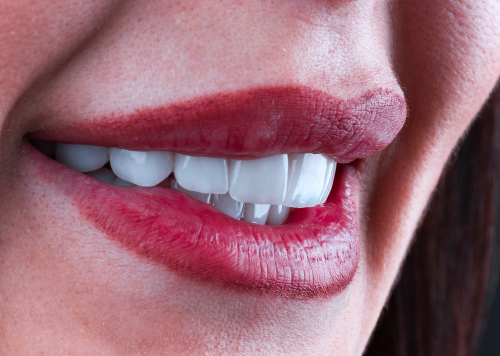 عملية-هوليود-سمايل