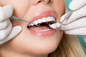 خطوات-تركيب-الفينير