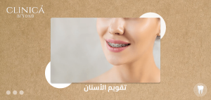 تقويم الاسنان