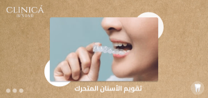 تقويم الأسنان المتحرك