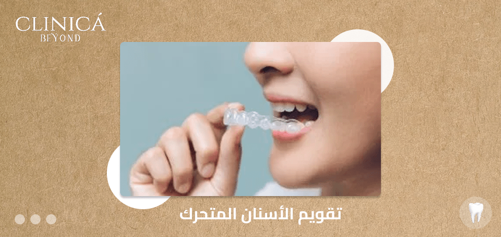 تقويم الأسنان المتحرك