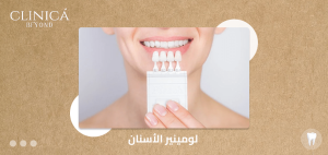 لومينير الأسنان