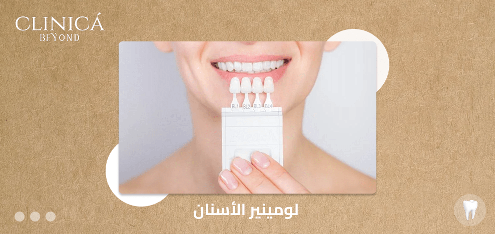 لومينير الأسنان