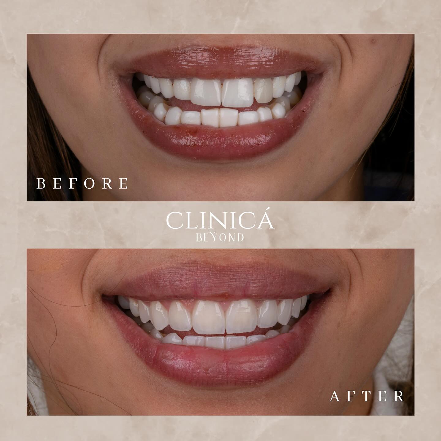 اسعار-تقويم-الاسنان-في-مصر