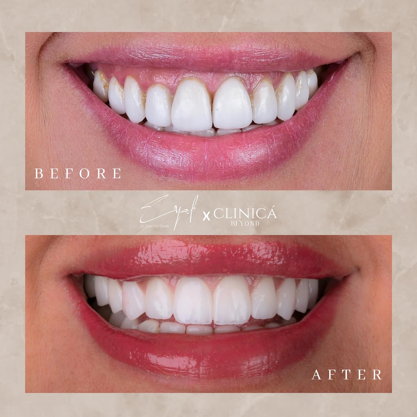 تجميل-الاسنان