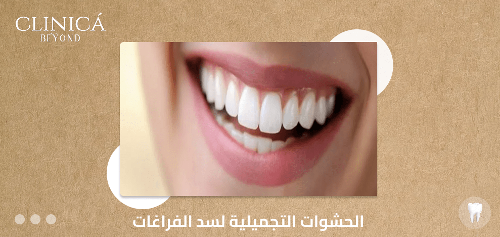 الحشوات التجميلية لسد الفراغات