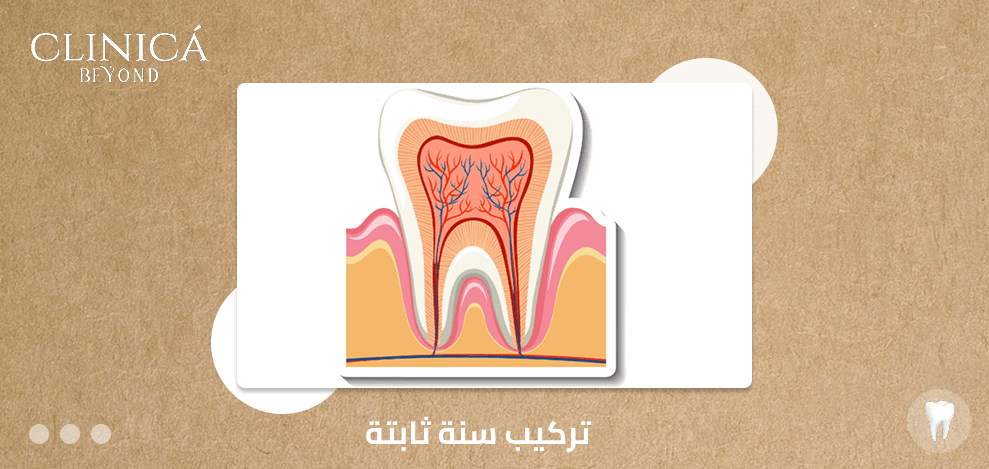 علاج جذور الاسنان المكشوفه