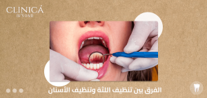 الفرق بين تنظيف اللثة وتنظيف الأسنان