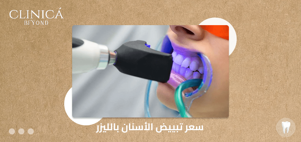 سعر تبييض الأسنان بالليزر