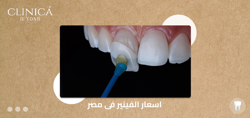 اسعار الفينير فى مصر