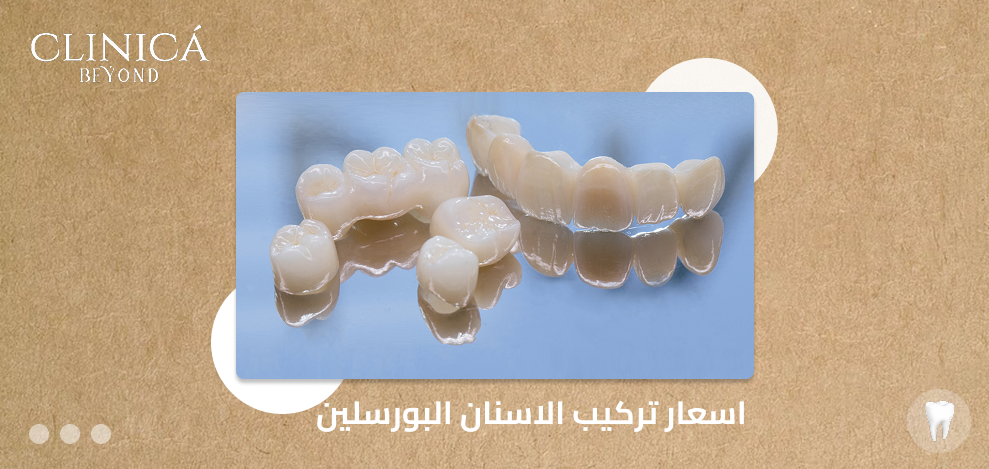 اسعار تركيب الاسنان البورسلين