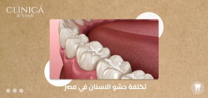 تكلفة حشو الاسنان في مصر