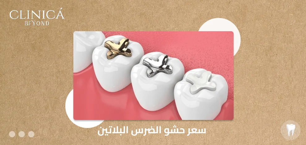 سعر حشو الضرس البلاتين