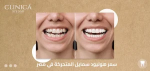 سعر هوليود سمايل المتحركة في مصر