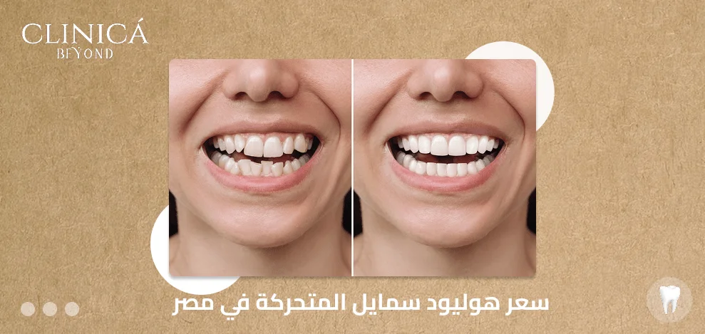 سعر هوليود سمايل المتحركة في مصر